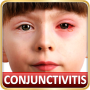 icon Help & Home Remedies For Pinkeye conjunctivitis in Kids