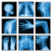 icon Medical X-Ray Interpretation 4.0.2